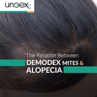 Demodex Vs Alopecia PickP