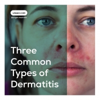 Three Common Types of Dermatitis