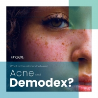 ✅ What is the relation between acne and Demodex mites?