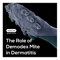 The Role of Demodex Mite in Dermatitis