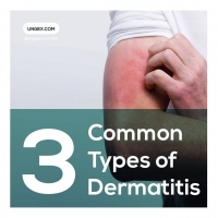 Three Common Types of Dermatitis