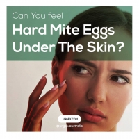 Can You Feel Hard Mite Eggs Under The Skin? PickP