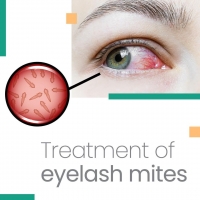 Treatment of eyelash mites PickP