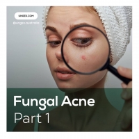 What Is Fungal Acne?