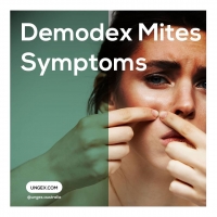 Demodex symptoms