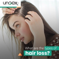 What are the types of hair loss? PickP