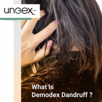 What is Demodex Dandruff ?