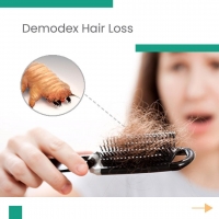 Demodex Hair Loss