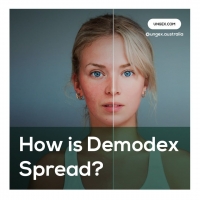 How is Demodex Spread?
