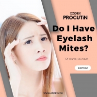 Do I have Eyelash mites?
