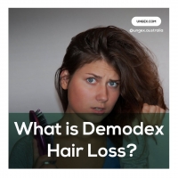 What is Demodex Hair loss? PickP