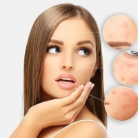 Meet Your Skin Pests. 😳
