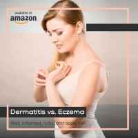 Dermatitis VS Eczema