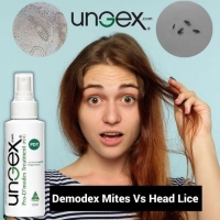Demodex mites are different to head lice.