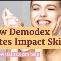 How Demodex Mites Impact Skin And how Ozidex can help PickP