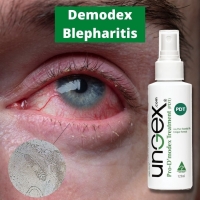 What is the recommended Demodex blepharitis treatment? 🤨
