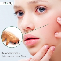 Demodex mites Existence on Your skin