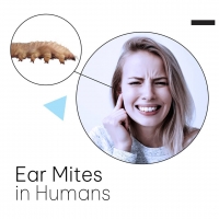 Ear Mites in Humans PickP