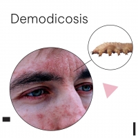 Demodicosis PickP