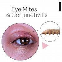 Eye Mites and Conjunctivitis PickP