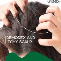 Demodex and Itchy Scalp