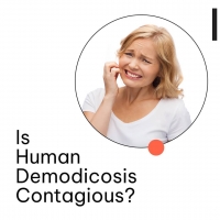 Is Human Demodicosis Contagious? PickP