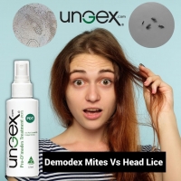 Demodex mites are different to head lice. PickP