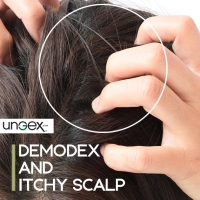 Demodex and Itchy Scalp