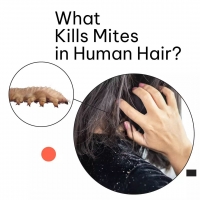 What Kills Mites in Human Hair?