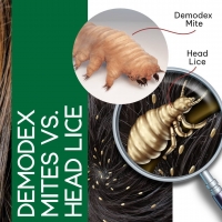 Demodex Mites vs. Head Lice PickP