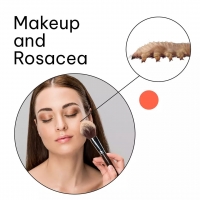 Makeup and Rosacea PickP