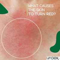 What Causes the Skin to Turn Red? PickP