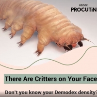 Don't Look Now, But There Are Critters on Your Face! PickP