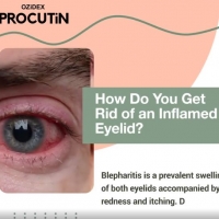 How do you get rid of an inflamed eyelid?