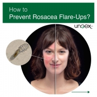 How to Prevent Rosacea Flare-Ups