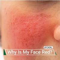 Why Is My Face Red?