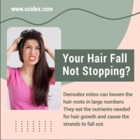 your hair fall not stopping?