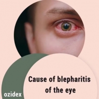 Cause of blepharitis of the eye