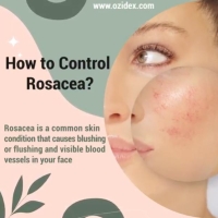 How to control rosacea? PickP