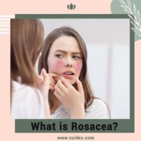 What is Rosacea? 🤔 PickP