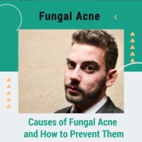 Causes of Fungal Acne and How to Prevent Them 🤔 PickP