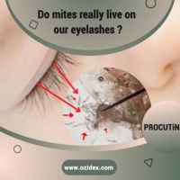Do mites really live on our eyelashes ?! PickP